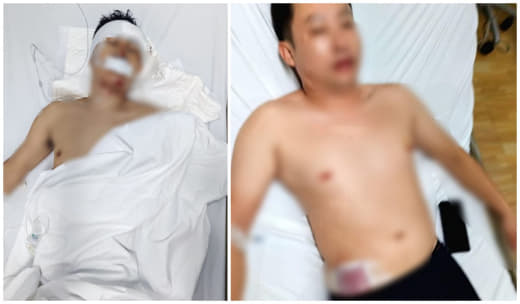 两名中国男子在工厂门口被人打成重伤