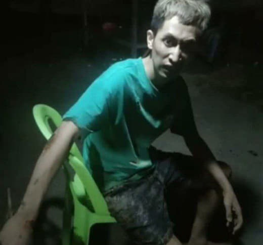 柬埔寨一名中国人夜晚当街求助，手脚都有伤！