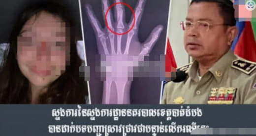 一外国女子乘坐嘟嘟车跳车，柬埔寨警方已展开调查！